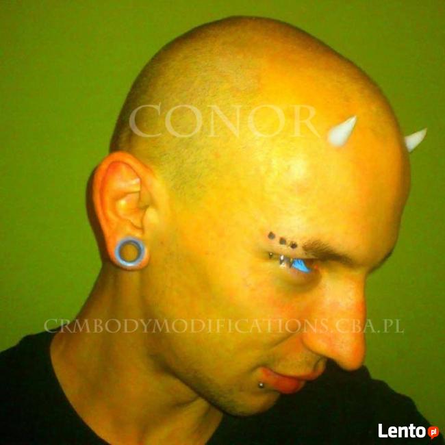 MODYFIKACJE CIAŁA - PIERCING, SKARYFIKACJE, IMPLANTY