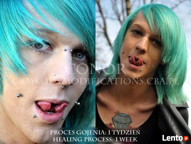 Modyfikacje ciala-skaryfikacje, rekonstrukcja uszu i inne.
