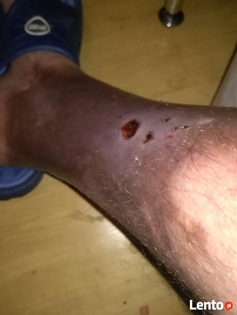 Świat Michała to mieszkanie i szpital. Pomóżmy mu wrócić do