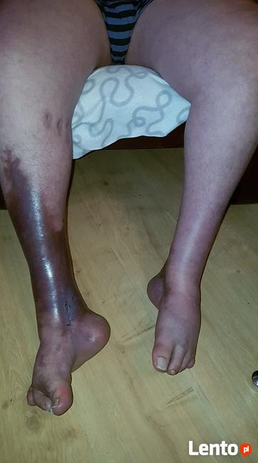 Świat Michała to mieszkanie i szpital. Pomóżmy mu wrócić do