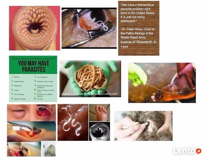 Zapper Rife oryginalny z regulacja mocy.