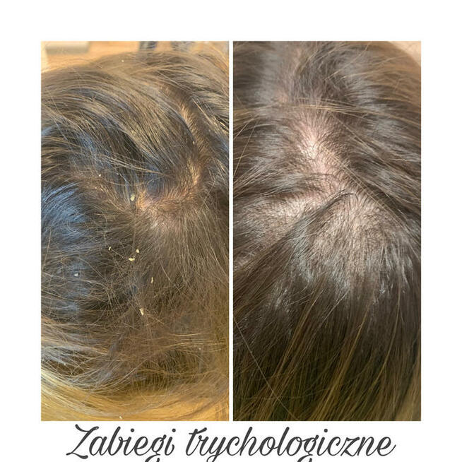 Trycholog