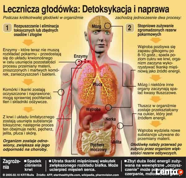 odtrucia alkocholowe/kroplówki nawadniające/witaminowe