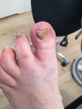 Specjalista Podolog - Wizyty domowe z dojazdem do pacjenta.