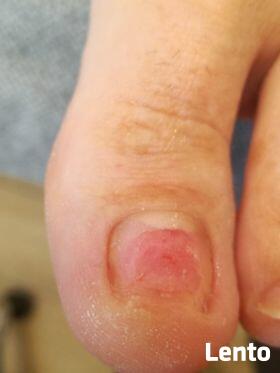 Specjalista Podolog - Wizyty domowe z dojazdem do pacjenta.