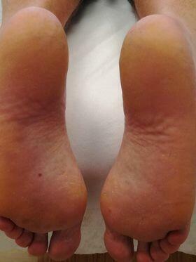 Specjalista Podolog - Wizyty domowe z dojazdem do pacjenta.