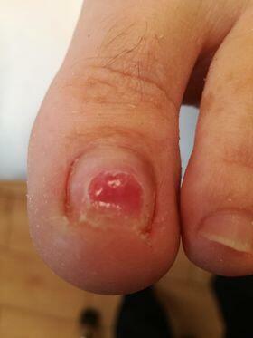 Specjalista Podolog - Wizyty domowe z dojazdem do pacjenta.