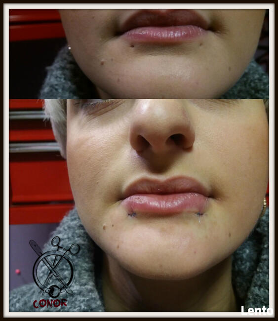 MODYFIKACJE CIAŁA - PIERCING, SKARYFIKACJE, IMPLANTY