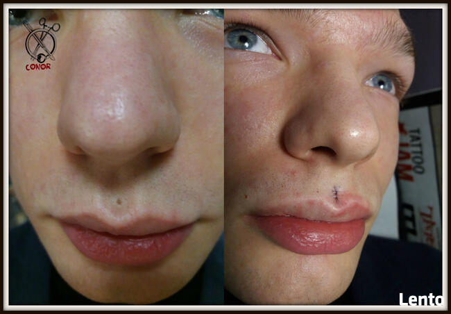 MODYFIKACJE CIAŁA - PIERCING, SKARYFIKACJE, IMPLANTY