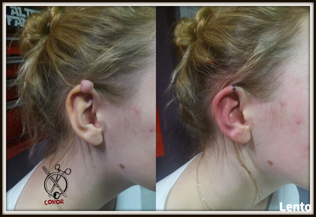 MODYFIKACJE CIAŁA - PIERCING, SKARYFIKACJE, IMPLANTY