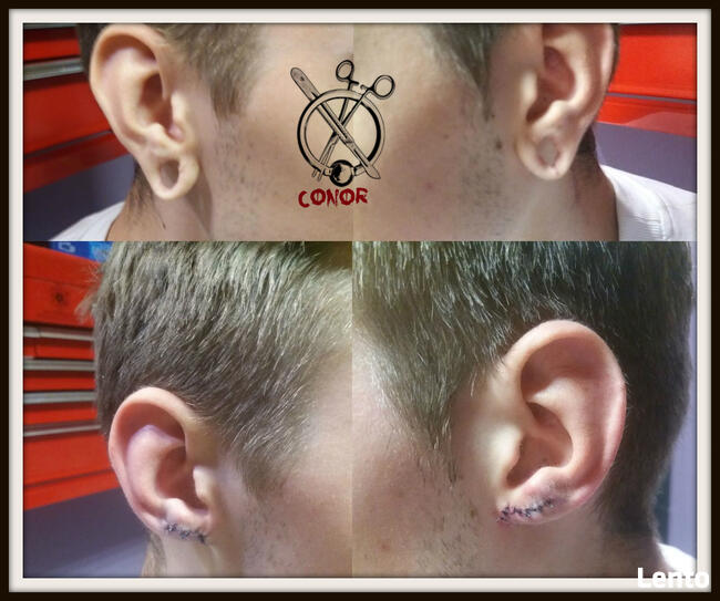 PIERCING SKARYFIKACJE IMPLANTY i inne - Warszawa