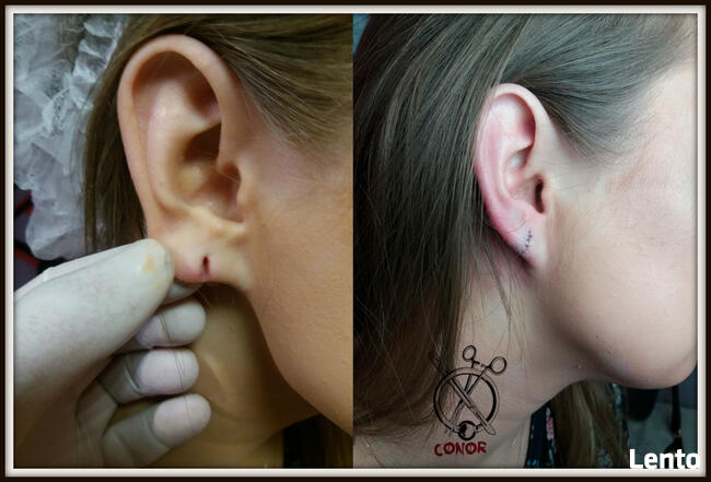 PIERCING SKARYFIKACJE IMPLANTY i inne - Warszawa