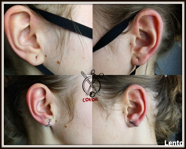 MODYFIKACJE CIAŁA - PIERCING, SKARYFIKACJE, IMPLANTY