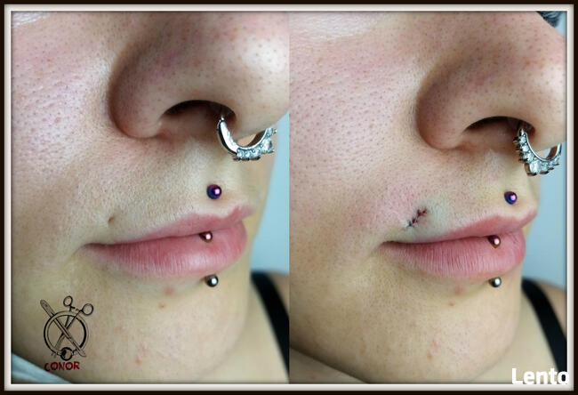 MODYFIKACJE CIAŁA - PIERCING, SKARYFIKACJE, IMPLANTY