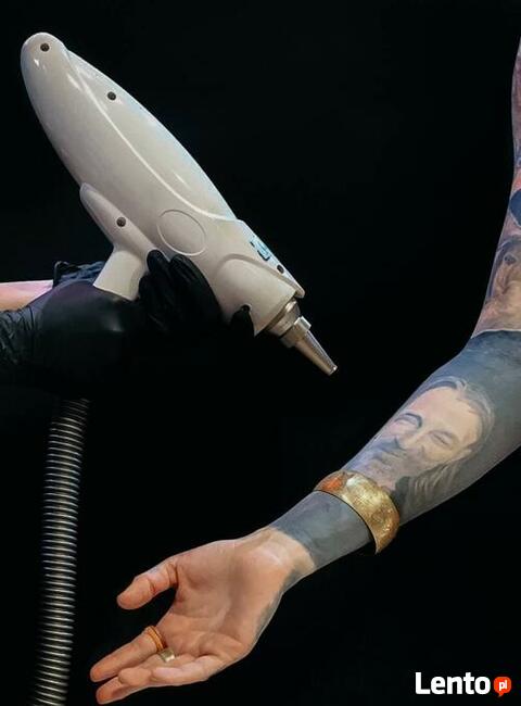Laserowe usuwanie tatuażu w VeAn