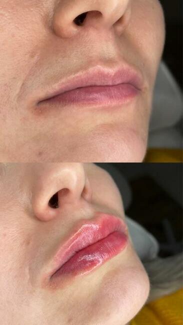 Powiększanie ust. Makijaż permanentny brwi i ust. Promocja