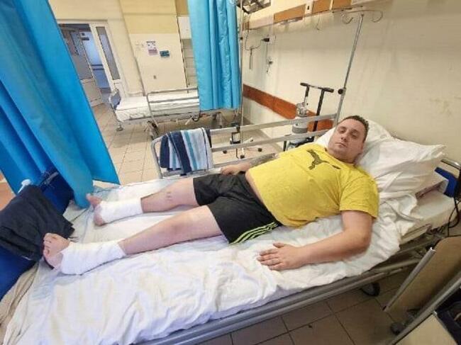 Pilna pomoc cegiełka 10 zł Udaje się uniknąć amputacji