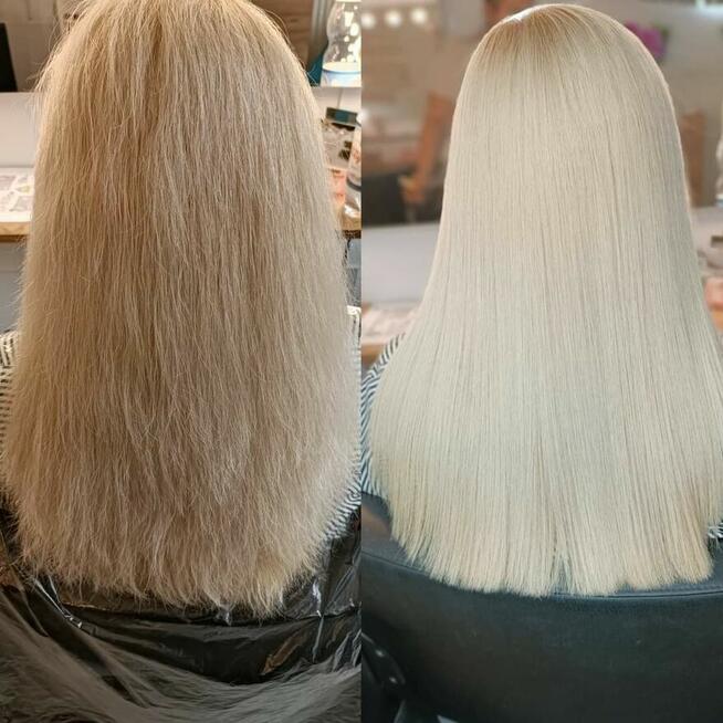 Nanoplastia PROMOCJA od 150zł zabieg