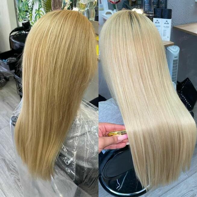 Nanoplastia PROMOCJA od 150zł zabieg