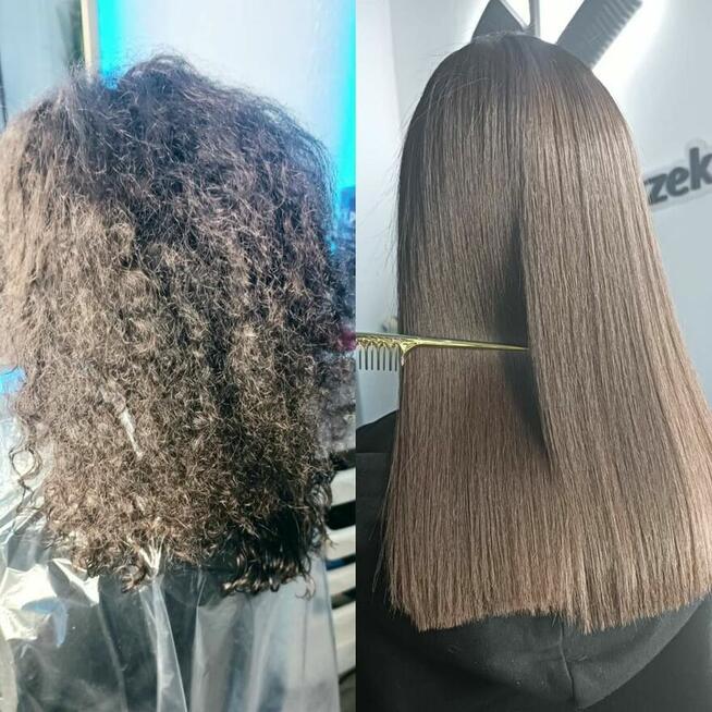 Nanoplastia PROMOCJA od 150zł zabieg