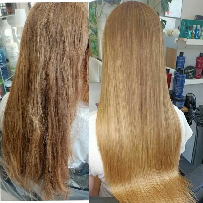 Nanoplastia PROMOCJA od 150zł zabieg