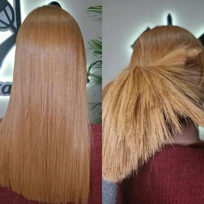 Nanoplastia PROMOCJA od 150zł zabieg