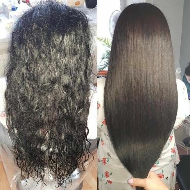 Nanoplastia PROMOCJA od 150zł zabieg