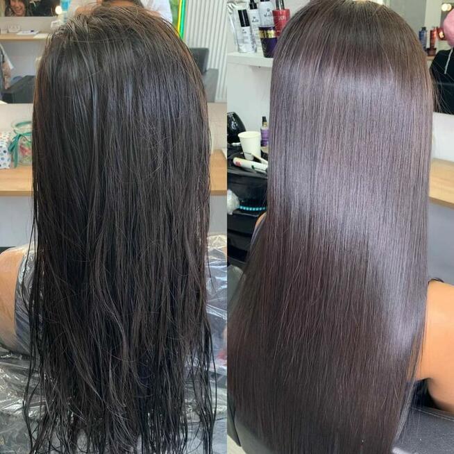 Nanoplastia PROMOCJA od 150zł zabieg