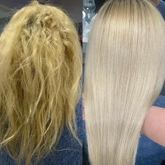 Nanoplastia PROMOCJA od 150zł zabieg