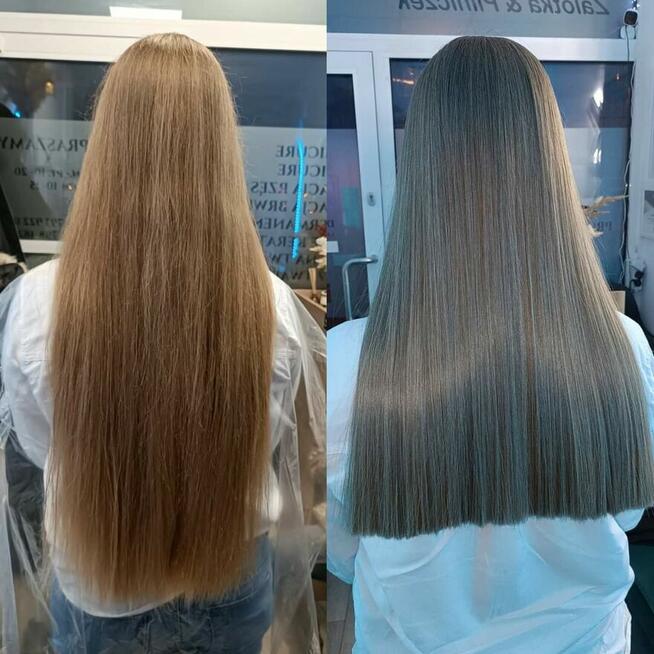 Nanoplastia PROMOCJA od 150zł zabieg