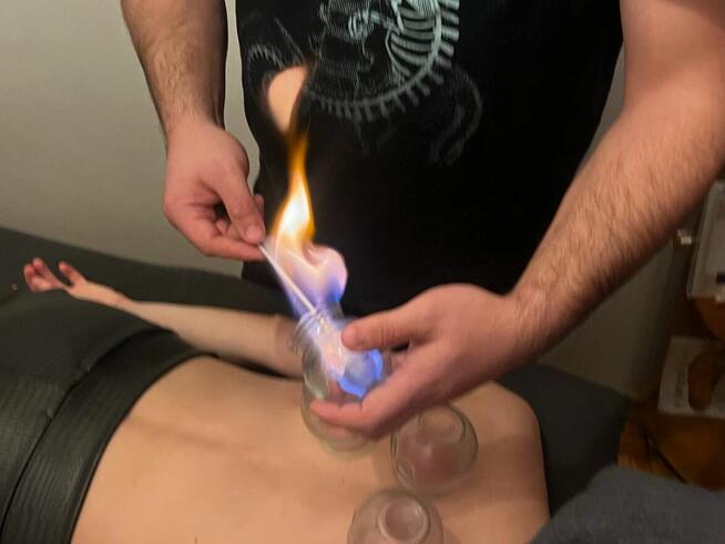 Bańki ogniowe m. klasyczny antycellulitowy drenaż