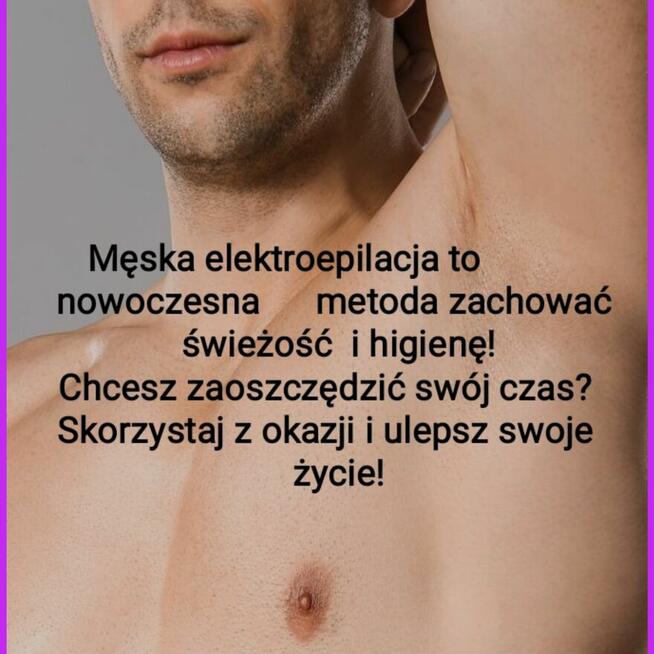 ELEKTROEPILACJA