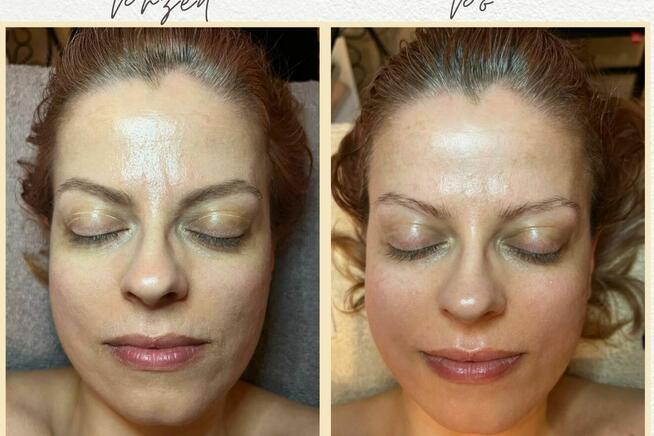 PROFESJONALNE KURSY SZKOLENIA KOBIDO KORUGI KOBIDO BODY