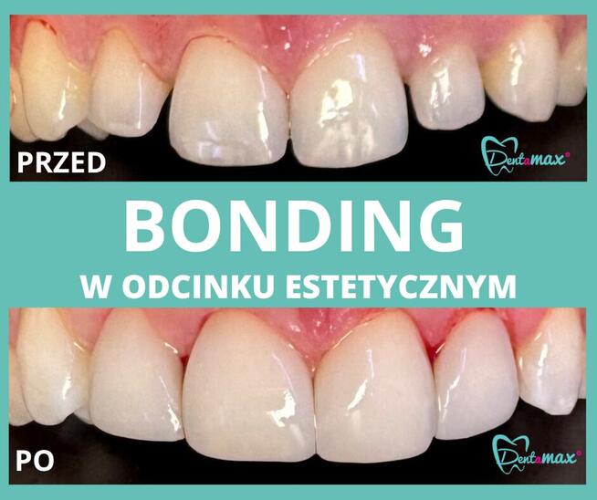Stomatologia Estetyczna - Dentamax Kraków