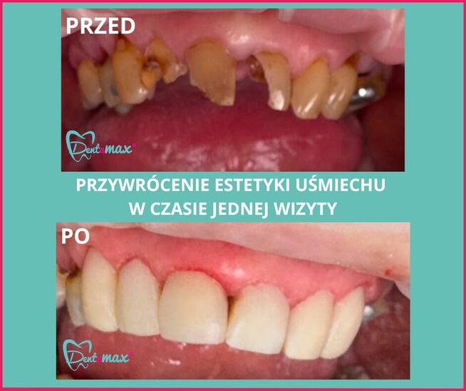 Stomatologia Estetyczna - Dentamax Kraków