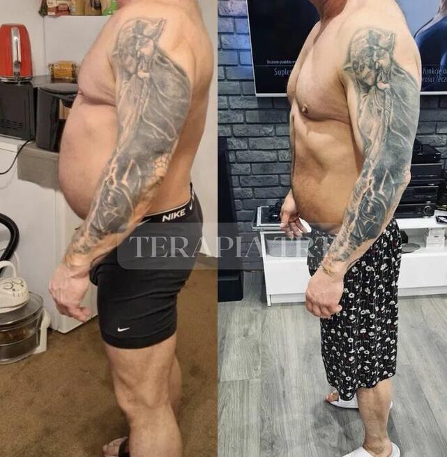 Terapia zastępcza testosteron