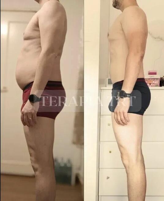 Terapia zastępcza testosteron