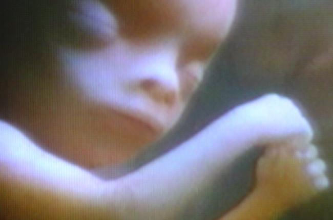 BEZPŁATNA SZKOŁA RODZENIA CENTRUM DYDAKTYCZNEGO IPS