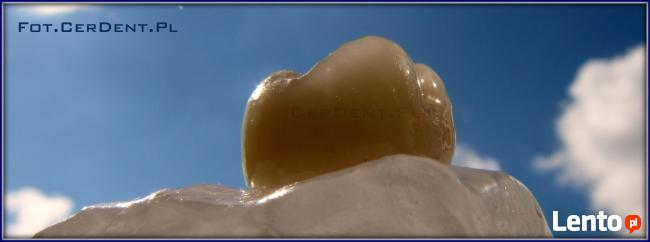 CerDent Laboratorium Protetyczne Naprawa Protez Warszawa