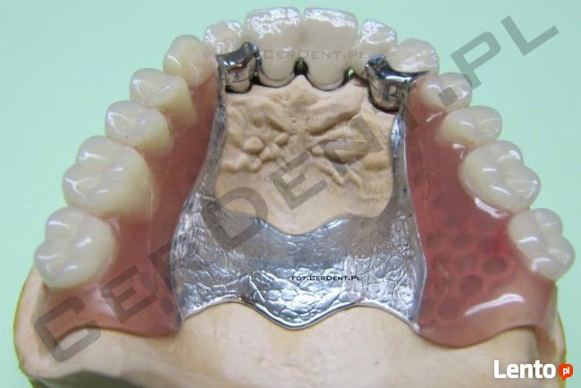 CerDent Laboratorium Protetyczne Naprawa Protez Warszawa