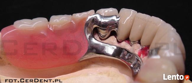 Naprawa Protez Pogotowie Protetyczne Warszawa