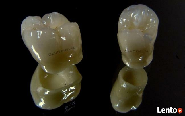 Naprawa Protez Pogotowie Protetyczne Warszawa