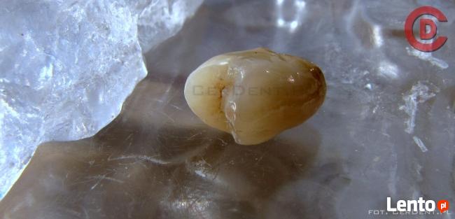 Naprawa Protez Pogotowie Protetyczne Warszawa