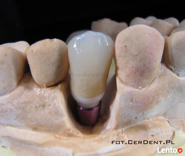 Naprawa Protez Pogotowie Protetyczne Warszawa