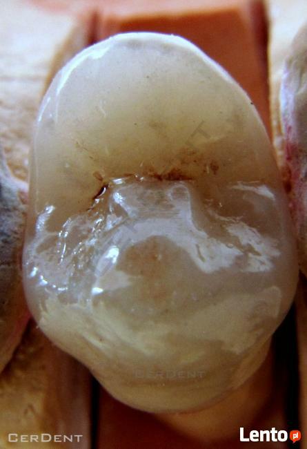 Naprawa Protez Pogotowie Protetyczne Warszawa