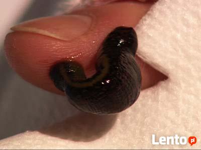 Leczenie Pijawkami Lekarskimi Natur Wit Bytom