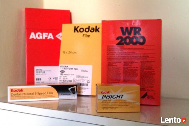 Zdięcia klisze RTG kupię 506-348-194