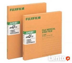 Zdięcia klisze RTG kupię 506-348-194