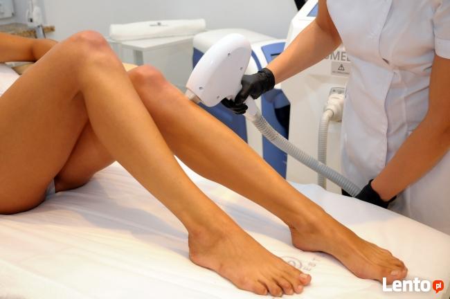 Depilacja Laserowa, Usuwanie Owłosienia: Nóg, Bikini, Kraków