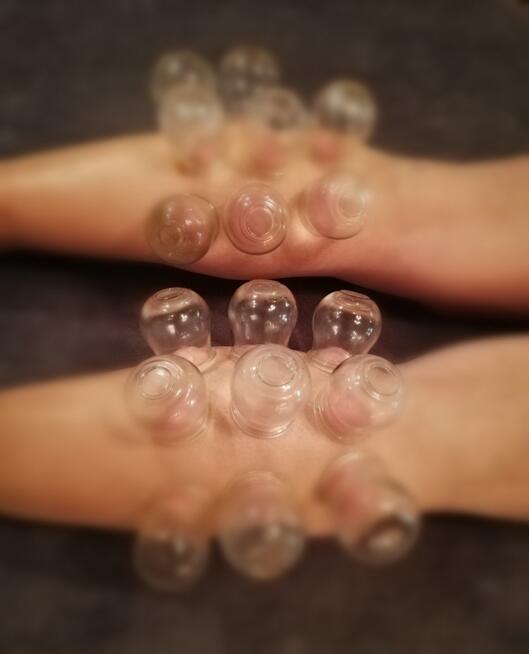 Stawianie baniek lekarskich